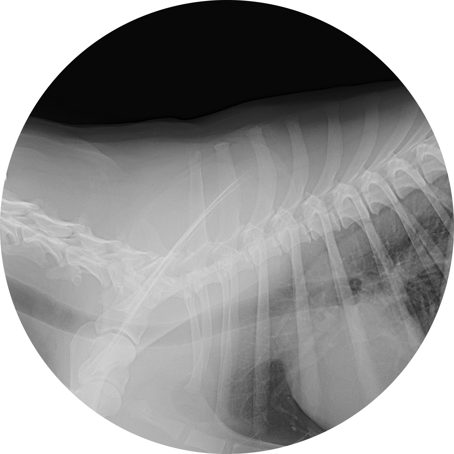 x-ray